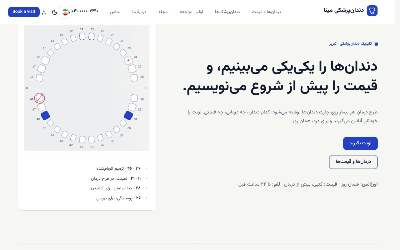 طرح درمان، روی چارت دندان‌ها